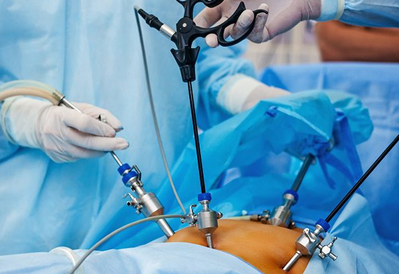 General and Laparoscopic Surgery